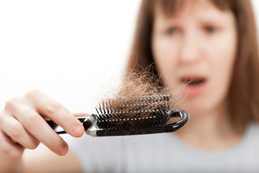 Hair Loss in Women
